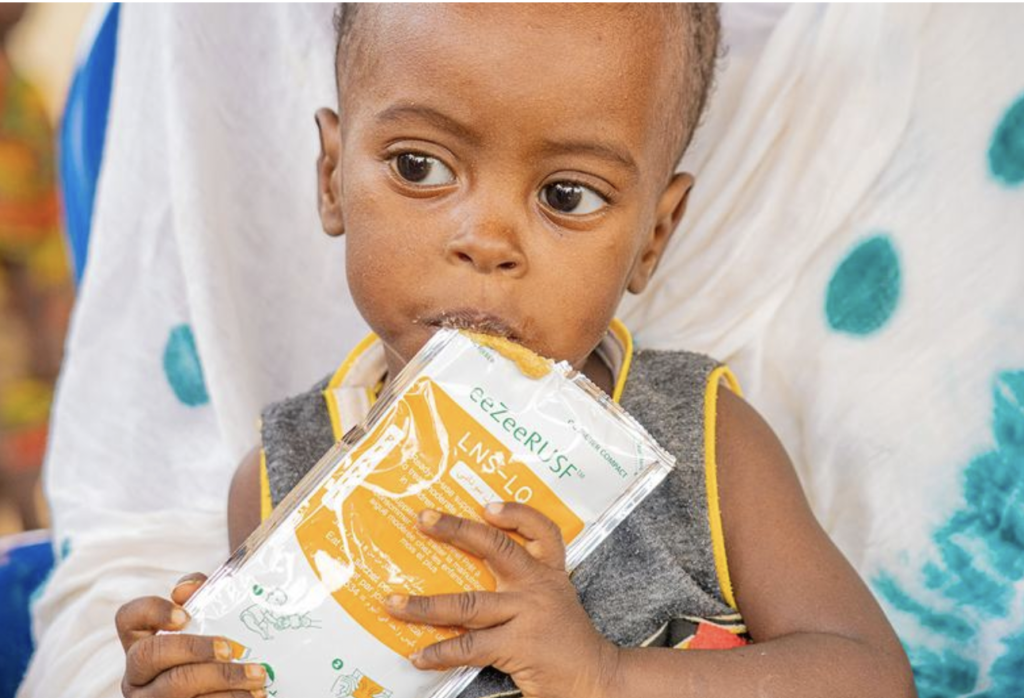 Gıdaya erişim hakkının herkes için sağlanması çok büyük yatırım gerektiriyor