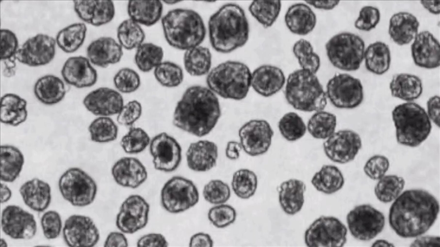 Antrobotlar: İnsan hücrelerinden üretilen küçük biyolojik robotlar 