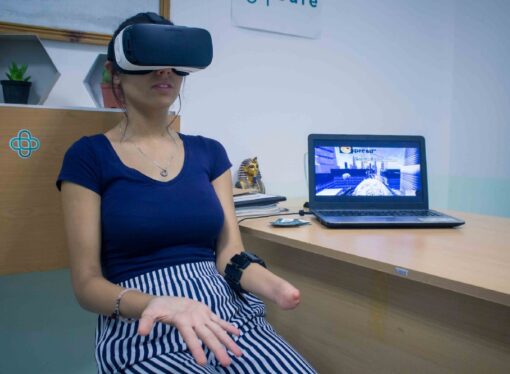 3D teknolojisi ve güneş enerjisi ile biyonik protez uzuv geliştiren girişim: Cure Bionics