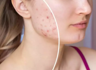 Grupo Boticário Alfa Kuşağı’nın cilt bakım çılgınlığına karşı harekete geçti